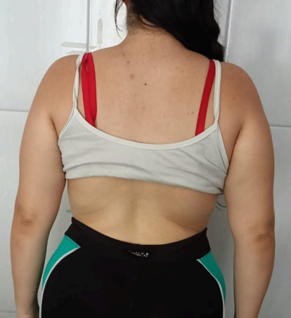 Depois - Melhora postural & definição