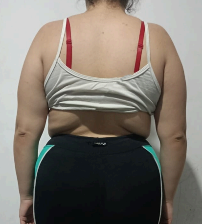 Antes - Melhora postural & definição
